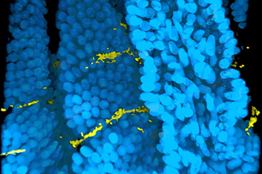 Cholera studies reveal mechanisms of biofilm formation & hyperinfectivity