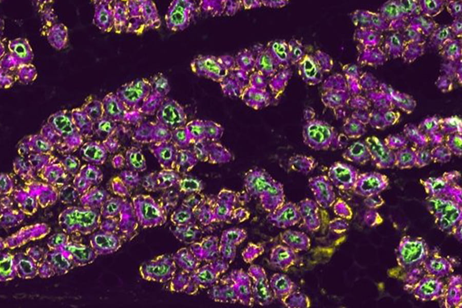 Milk-producing alveoli in the pregnant murine mammary gland. Luminal cells are labeled by Cytokeratin-18 (CK18, purple) and basal/myoepithelial cells are labeled by Smooth Muscle Actin (SMA, yellow) and milk is represented in green. (Photo by Julien Menendez)